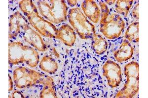 Immunohistochemistry of paraffin-embedded human kidney tissue using ABIN7159794 at dilution of 1:100 (MAST3 antibody  (AA 1101-1309))