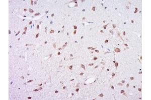 Paraformaldehyde-fixed, paraffin embedded rat brain, Antigen retrieval by boiling in sodium citrate buffer (pH6) for 15min, Block endogenous peroxidase by 3% hydrogen peroxide for 30 minutes, Blocking buffer (normal goat serum) at 37°C for 20min, Antibody incubation with Rabbit Anti-Profilin 1 Polyclonal Antibody, Unconjugated  at 1:500 overnight at 4°C, followed by a conjugated secondary and DAB staining. (PFN1 antibody  (AA 41-140))