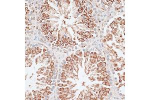 Immunohistochemistry of paraffin-embedded Mouse testis using KIF2C/MCAK antibody (ABIN6128155, ABIN6142869, ABIN6142870 and ABIN6221103) at dilution of 1:100 (40x lens). (KIF2C antibody  (AA 1-190))