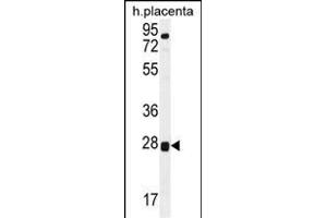 TOR2A Antibody (Center) (ABIN656112 and ABIN2850491) western blot analysis in human placenta tissue lysates (35 μg/lane).