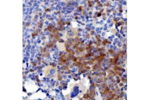 IHC analysis of IL3 using anti-IL3 antibody (ABIN7602653). (IL-3 antibody  (AA 91-166))