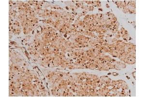 Immunohistochemistry (IHC) image for anti-Microtubule-Associated Protein tau (MAPT) (pSer262) antibody (ABIN6256228)