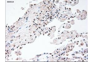 Image no. 1 for anti-Glial Fibrillary Acidic Protein (GFAP) antibody (ABIN1498436) (GFAP antibody)
