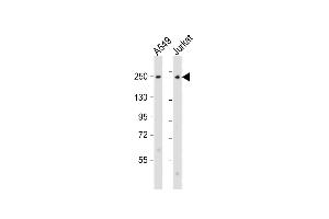 All lanes : Anti-COL11A1 Antibody (N-Term) at 1:2000 dilution Lane 1: A549 whole cell lysate Lane 2: Jurkat whole cell lysate Lysates/proteins at 20 μg per lane. (COL11A1 antibody  (AA 41-75))