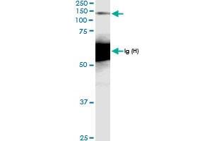 Immunoprecipitation of MCM2 transfected lysate using anti-MCM2 MaxPab rabbit polyclonal antibody and Protein A Magnetic Bead , and immunoblotted with MCM2 MaxPab rabbit polyclonal antibody (D01) .