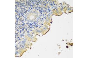 Immunohistochemistry of paraffin-embedded human appendix using CLN5 antibody (ABIN6133293, ABIN6138735, ABIN6138736 and ABIN6216682) at dilution of 1:150 (40x lens). (CLN5 antibody  (AA 96-407))