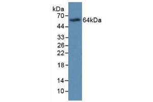 Western blot analysis of recombinant Human MBP. (Major Basic Protein antibody  (AA 105-222))