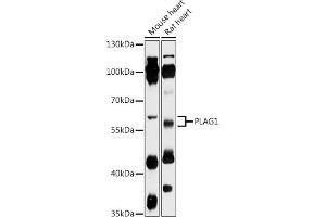 Western blot analysis of extracts of various cell lines, using PL antibody (ABIN7269418) at 1:1000 dilution. (PLAG1 antibody  (AA 33-288))