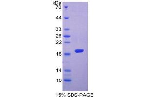 SDS-PAGE (SDS) image for ADAM Metallopeptidase with thrombospondin Type 1 Motif, 5 (ADAMTS5) (AA 485-622) protein (His tag) (ABIN1878590)