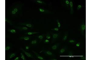 Immunofluorescence of monoclonal antibody to HDAC3 on HeLa cell. (HDAC3 antibody  (AA 1-428))