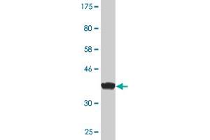 Western Blot detection against Immunogen (38. (ZAK antibody  (AA 1-120))