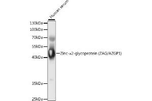 Western blot analysis of extracts of human serum, using Zinc-α2-glycoprotein (ZAG/Zinc-α2-glycoprotein (ZAG/)) antibody (ABIN6131435, ABIN6137386, ABIN6137387 and ABIN6221006) at 1:1000 dilution.