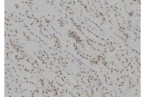 ABIN6277620 at 1/100 staining Human kidney tissue by IHC-P. (UBE2C antibody  (C-Term))
