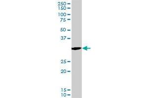 PCNA monoclonal antibody (M04), clone S1. (PCNA antibody  (AA 1-261))