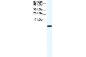 CCL5 antibody (20R-1137) used at 1. (CCL5 antibody  (Middle Region))