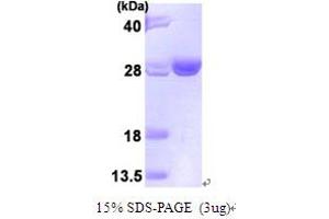 SDS-PAGE (SDS) image for Ubiquitin-Conjugating Enzyme E2T (Ube2t) (AA 1-197) protein (His tag) (ABIN666977)