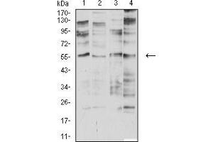 Western blot analysis using CHRNA2 mouse mAb against SK-N-SH (1), SH-SY5Y (2), membrane protein of C6 (3), and SW480 (4) cell lysate. (CHRNA2 antibody  (AA 27-264))