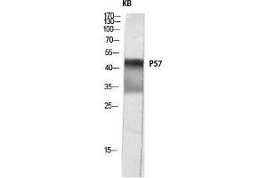 Western Blot (WB) analysis of KB lysis using p57 antibody. (P57 (Ser238) antibody)
