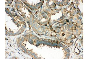 Immunohistochemistry (IHC) image for anti-rho-Associated, Coiled-Coil Containing Protein Kinase 2 (ROCK2) (AA 652-923) antibody (ABIN3043921)