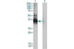 Western Blot analysis of LDLRAP1 expression in transfected 293T cell line by LDLRAP1 monoclonal antibody (M01), clone 4G4-D5.