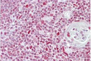 Immunohistochemistry with Thymus tissue at an antibody concentration of 5µg/ml using anti-NFATC3 antibody (P100975_P050) (NFATC3 antibody  (N-Term))