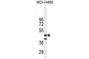 Western Blotting (WB) image for anti-Fibrinogen-Like 2 (FGL2) antibody (ABIN2996032) (FGL2 antibody)
