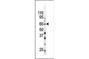 Image no. 1 for anti-SMAD, Mothers Against DPP Homolog 3 (SMAD3) (pSer213) antibody (ABIN358226) (SMAD3 antibody  (pSer213))