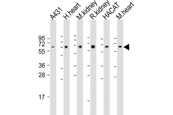Otopetrin 1 anticorps  (AA 360-388)