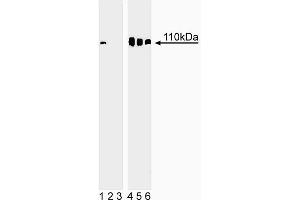Western blot analysis of Rb (pS780) in human embryonic skin cells. (Retinoblastoma 1 antibody  (pSer780))