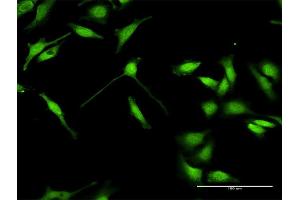 Immunofluorescence of purified MaxPab antibody to ELAVL4 on HeLa cell. (ELAVL4 antibody  (AA 1-366))