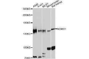 Western blot analysis of extracts of various cell lines, using NOMO1 antibody (ABIN5998361) at 1:7000 dilution. (NOMO1 antibody)
