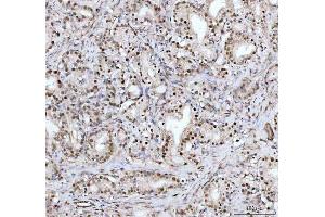 IHC analysis of DHX15/prp43 using anti-DHX15/prp43 antibody (ABIN7602738). (DHX15 antibody  (C-Term))