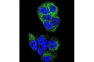 Confocal immunofluorescent analysis of HNF4A Antibody (N-term) (ABIN653385 and ABIN2842849) with MCF-7 cell followed by Alexa Fluor 488-conjugated goat anti-rabbit lgG (green).