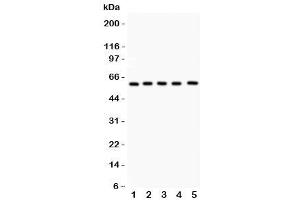 Western Blotting (WB) image for anti-Nuclear Receptor Subfamily 5, Group A, Member 2 (NR5A2) (AA 44-237) antibody (ABIN3032410)