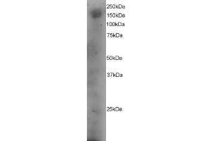 ABIN184630 staining (4µg/ml) of A431 lysate (RIPA buffer, 35µg total protein per lane). (DOCK1 antibody  (C-Term))