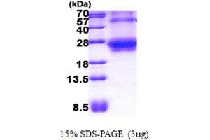 SDS-PAGE (SDS) image for Ras Homolog Gene Family, Member Q (RHOQ) (AA 1-202) protein (His tag) (ABIN5852957) (RHOQ Protein (AA 1-202) (His tag))