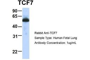 Host:  Rabbit  Target Name:  TCF7  Sample Type:  Human Fetal Lung  Antibody Dilution:  1. (TCF7 antibody  (Middle Region))
