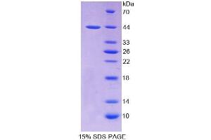 SDS-PAGE analysis of Rat PTHR2 Protein.