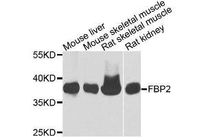 Western blot analysis of extracts of various cell lines, using FBP2 antibody. (FBP2 antibody  (AA 1-339))