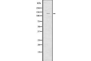 Western blot analysis of IRS4 using Jurkat whole  lysates. (IRS4 antibody  (C-Term))