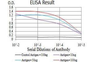 Black line: Control Antigen (100 ng);Purple line: Antigen (10ng); Blue line: Antigen (50 ng); Red line:Antigen (100 ng) (MIB1 antibody  (AA 6-221))