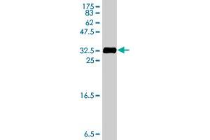 Western Blot detection against Immunogen (31. (TRPC3 antibody  (AA 485-535))