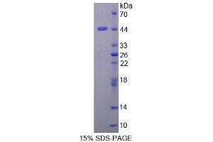 SDS-PAGE (SDS) image for Deoxyhypusine Synthase (DHPS) (AA 1-369) protein (His tag) (ABIN4989614) (DHPS Protein (AA 1-369) (His tag))