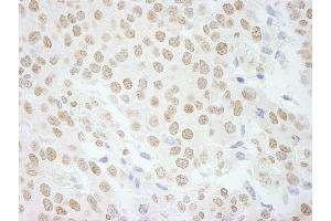 Immunohistochemistry (IHC) image for anti-Pleiotropic Regulator 1 (PLRG1) (AA 464-514) antibody (ABIN7449000) (PLRG1 antibody  (AA 464-514))