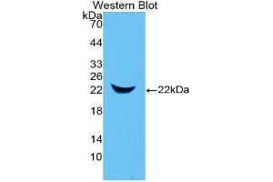 Western Blotting (WB) image for anti-Lipocalin 2 (LCN2) (AA 21-200) antibody (ABIN1078406) (Lipocalin 2 antibody  (AA 21-200))