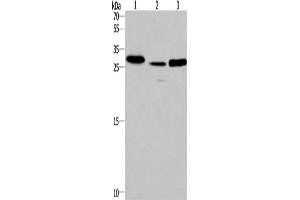 Western Blotting (WB) image for anti-Interleukin-1 Receptor-Associated Kinase 1 Binding Protein 1 (IRAK1BP1) antibody (ABIN2421755) (IRAK1BP1 antibody)