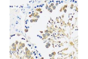 Immunohistochemistry of paraffin-embedded Mouse testis using CALM3 Polyclonal Antibody at dilution of 1:100 (40x lens). (Calmodulin 3 antibody)