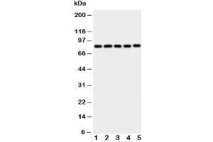 Western blot testing of Ku80 antibody and Lane 1:  Jurkat;  2: CEM;  3: Raji;  4: COLO320;  5: HT1080 cell lysate (XRCC5 antibody  (C-Term))