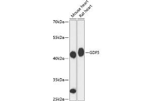 Western blot analysis of extracts of various cell lines, using GDF5 antibody (ABIN6133596, ABIN6141044, ABIN6141045 and ABIN6217062) at 1:3000 dilution.