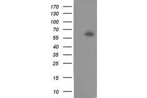 HEK293T cells were transfected with the pCMV6-ENTRY control (Left lane) or pCMV6-ENTRY CALCOCO2 (Right lane) cDNA for 48 hrs and lysed. (CALCOCO2 antibody)